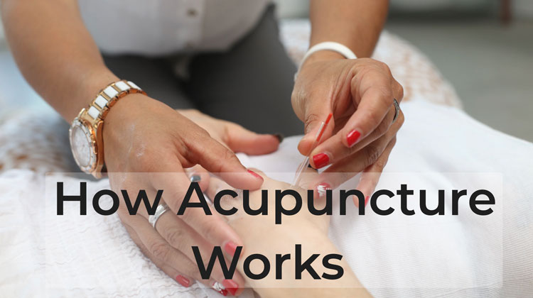 How Acupuncture Can Help You Improve Your Health