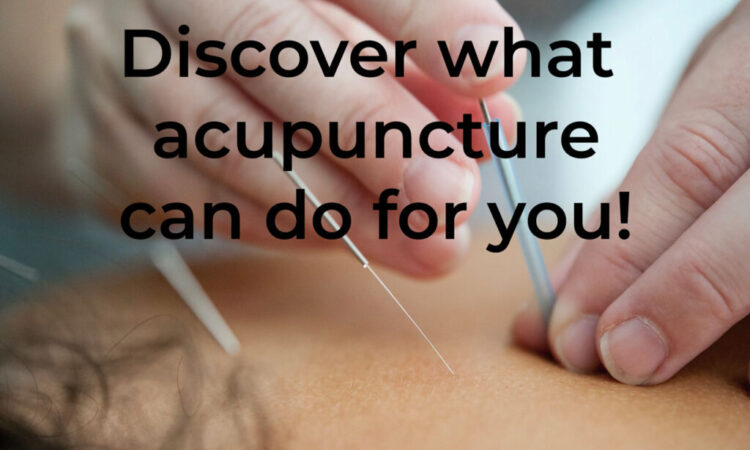 Acupuncturists: What Can They Do For You?