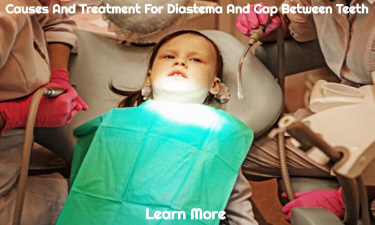 Causes And Treatment For Diastema And Gap Between Teeth