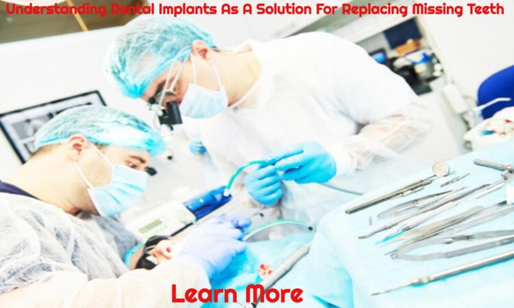 Understand Dental Implants As A Solution To Replace Missing Teeth