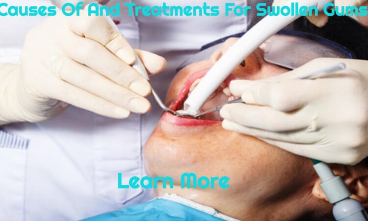 Causes Of And Treatments For Swollen Gums